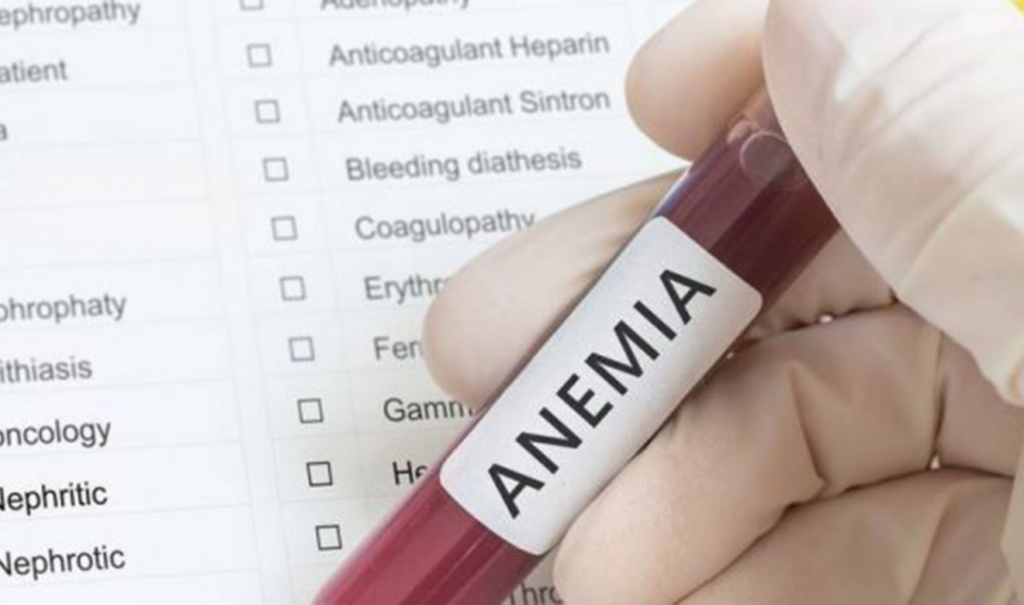 ¿Estás cansado todo el tiempo La anemia podría ser la razón