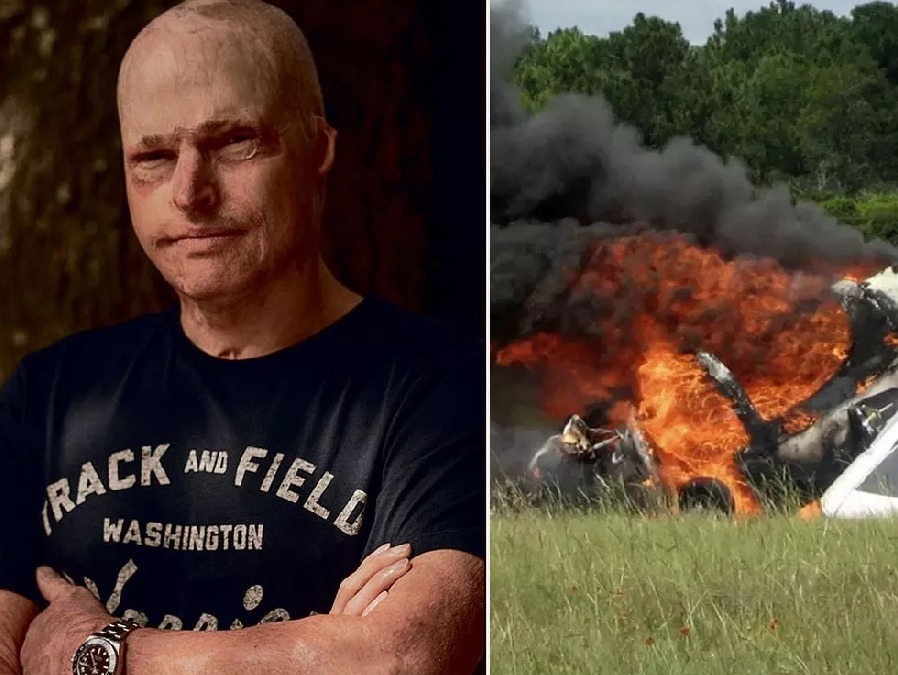 Jamie Hull, un exsoldado británico de 32 años, sobrevivió milagrosamente en 2007 tras saltar de un avión en llamas.