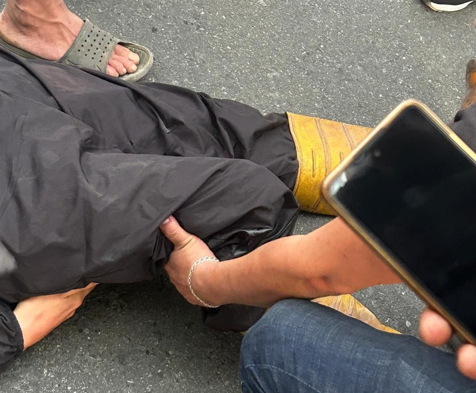 Motociclista pierde una pierna tras accidente con vehículo oficial en Santo Domingo
