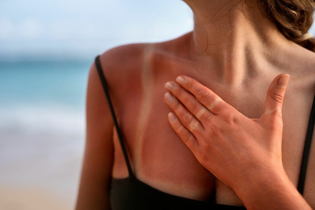 Alertan que broncearse daña la piel y eleva el riesgo de cáncer cutáneo