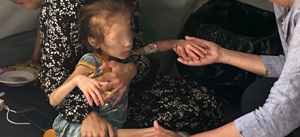 Hambruna en Gaza declarada por la ONU Medio millón de personas en riesgo. Fotografía UNOCHA