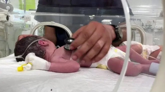 neonatologia, neonatal