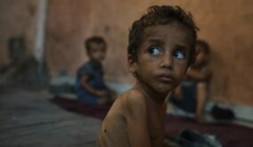El hambre en Gaza se ensaña con decenas de miles de niños: la malnutrición se triplica en menores de 5 años.