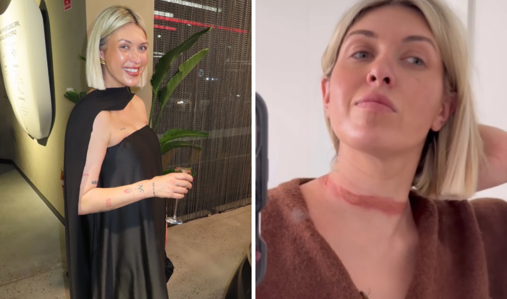 Reconocida influencer casi muere estrangulada por su vestido