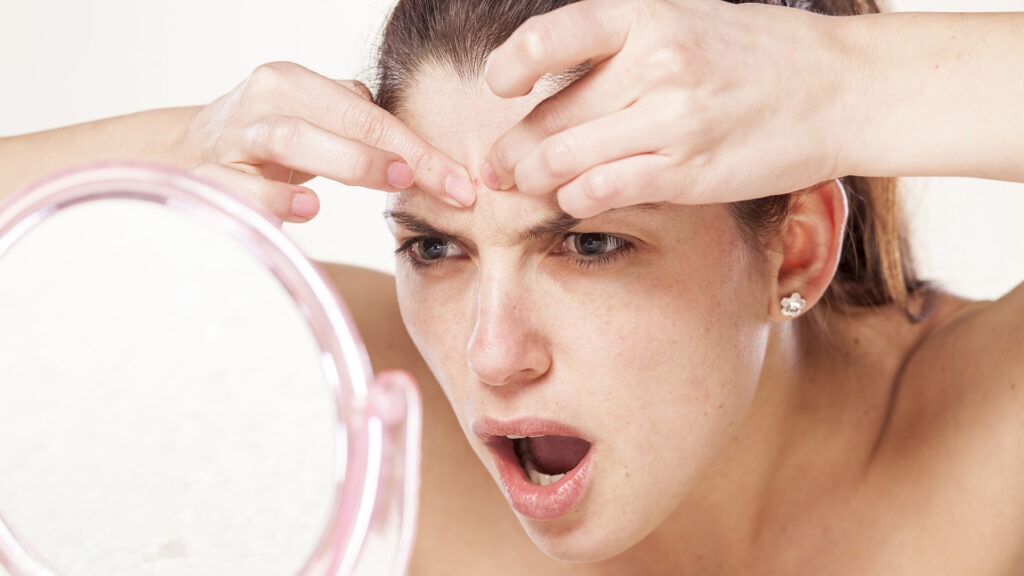 Dermatólogos advierten sobre los riesgos de reventar granos en el rostro