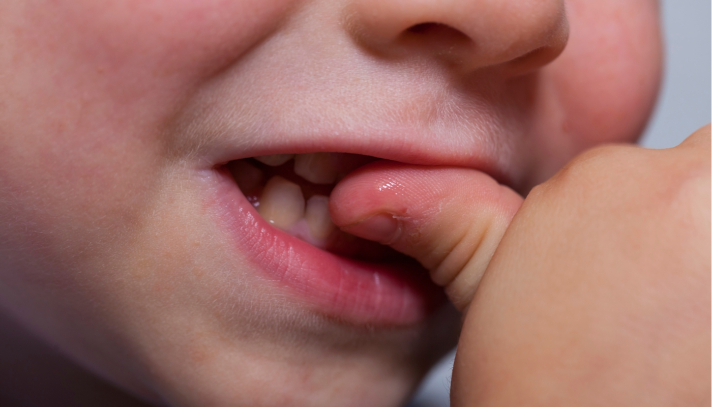 Cinco métodos eficaces para que los niños dejen de comerse las uñas