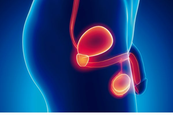 75% de los pacientes de cáncer de próstata logra curarse gracias a un diagnóstico precoz