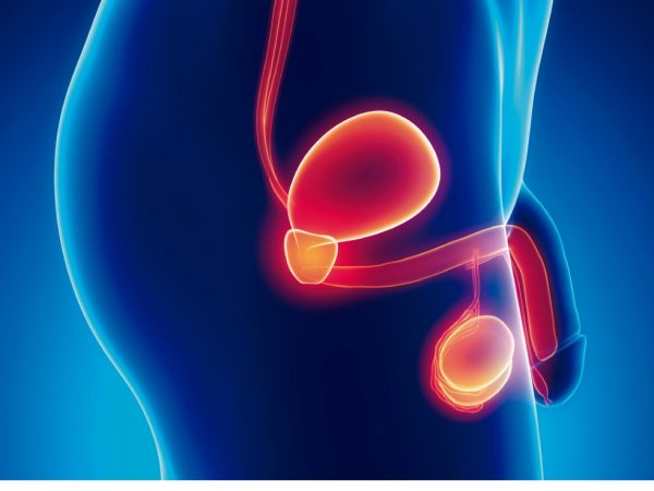75% de los pacientes de cáncer de próstata logra curarse gracias a un diagnóstico precoz