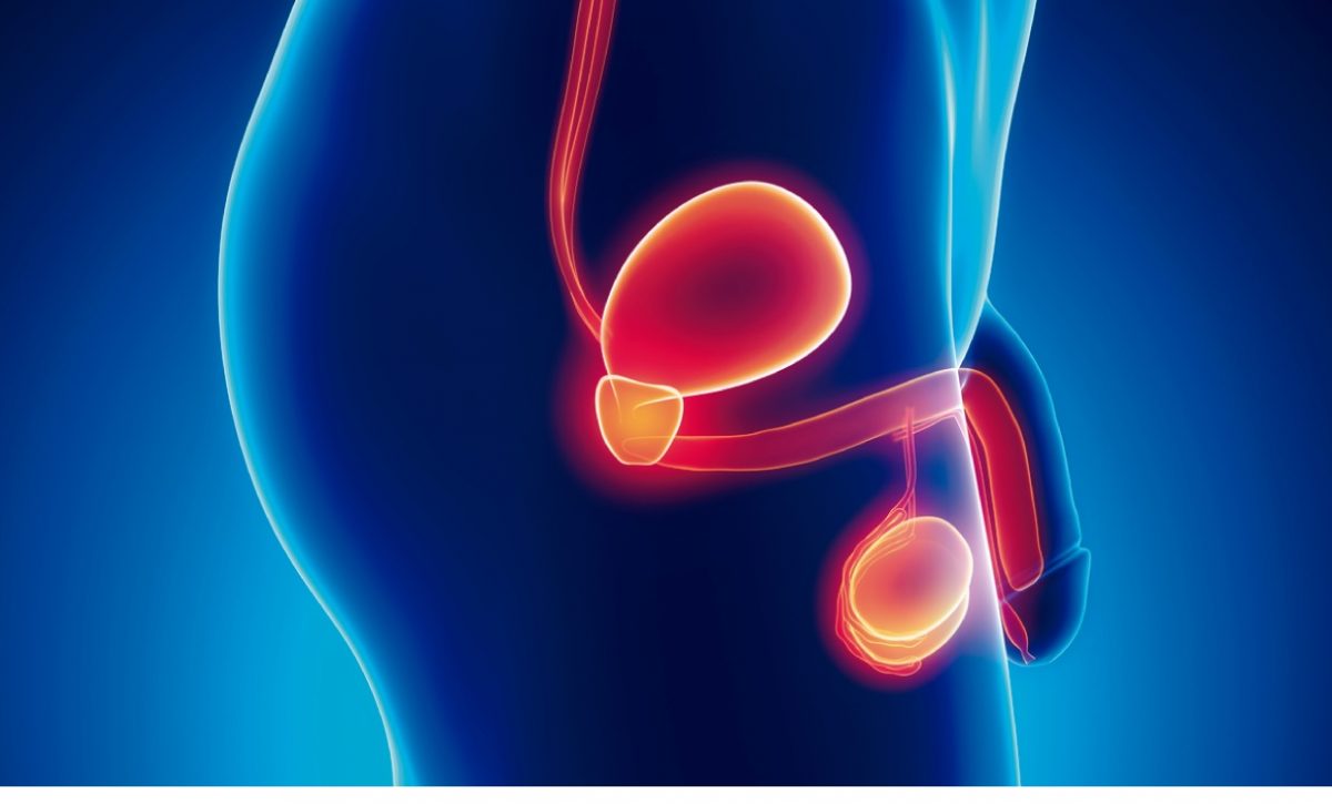75% de los pacientes de cáncer de próstata logra curarse gracias a un diagnóstico precoz