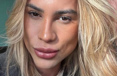 Murió el influencer brasileño que denunció a su cirujana antes de morir por una operación estética