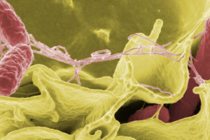 Bacteria 'come carne' ha matado a cuatro personas en Florida, Estados Unidos