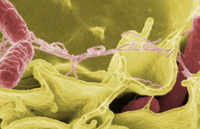 Bacteria 'come carne' ha matado a cuatro personas en Florida, Estados Unidos