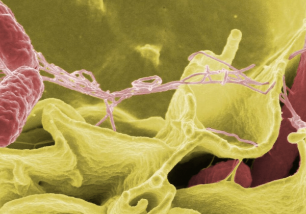 Bacteria 'come carne' ha matado a cuatro personas en Florida, Estados Unidos