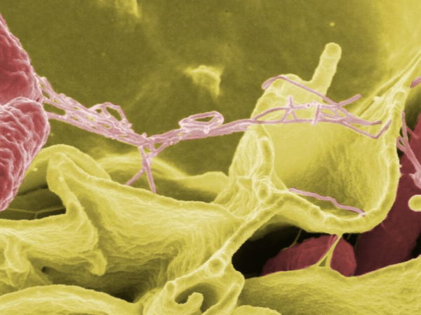 Bacteria 'come carne' ha matado a cuatro personas en Florida, Estados Unidos