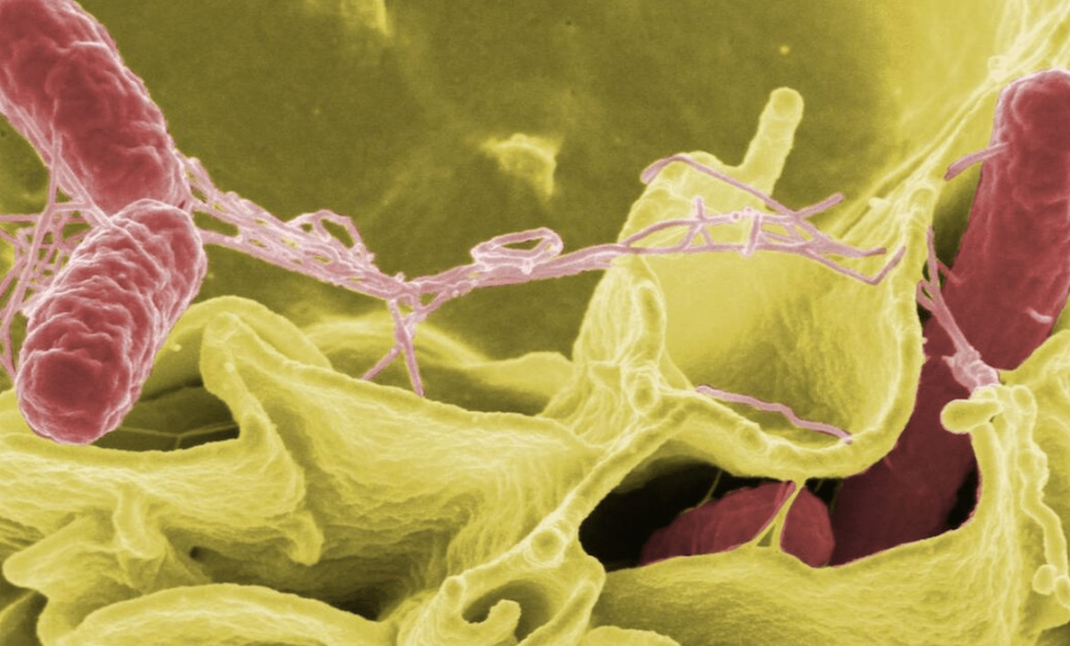Bacteria 'come carne' ha matado a cuatro personas en Florida, Estados Unidos