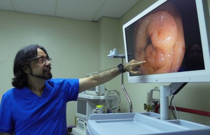 Cáncer de Colon disminuyó en un 25% en Manabí