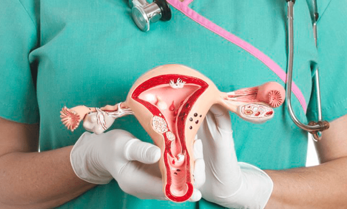 Claves para Reducir el Riesgo de Cáncer Cervicouterino