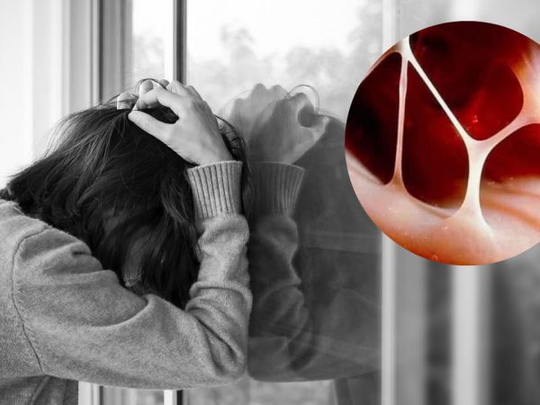 El corazón puede romperse literalmente por tristeza extrema, según estudios científicos