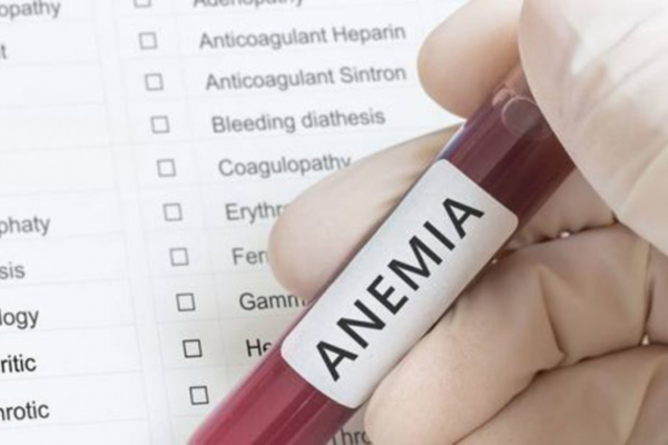 ¿Estás cansado todo el tiempo La anemia podría ser la razón