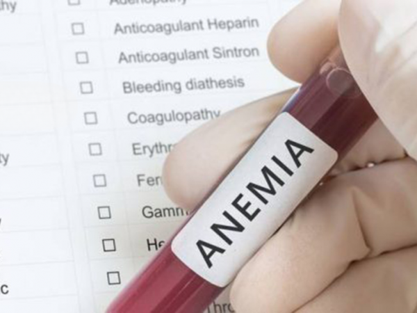 ¿Estás cansado todo el tiempo La anemia podría ser la razón