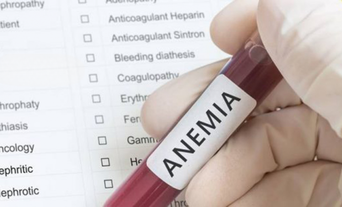 ¿Estás cansado todo el tiempo La anemia podría ser la razón