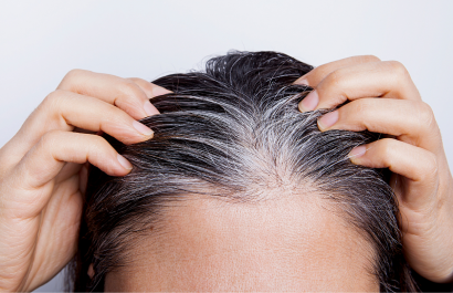 Estudio revela que la vitamina B5 podría ser clave para dejar atrás las canas