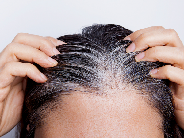 Estudio revela que la vitamina B5 podría ser clave para dejar atrás las canas