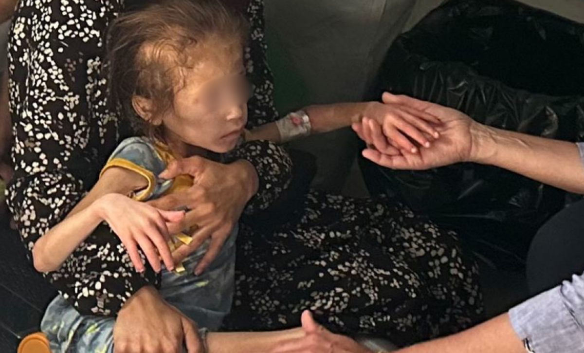 Hambruna en Gaza declarada por la ONU Medio millón de personas en riesgo. Fotografía UNOCHA