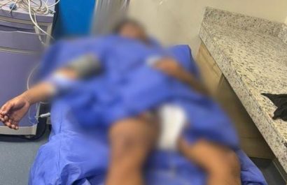 Un sospechoso fue herido tras atacar con arma de fuego a policías, en Manta. (Foto: X de la Policía Nacional).