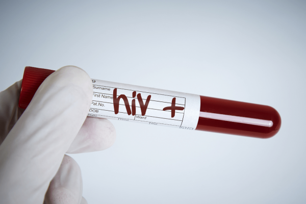 La OMS recomienda el lenacapavir inyectable para prevenir la infección por VIH
