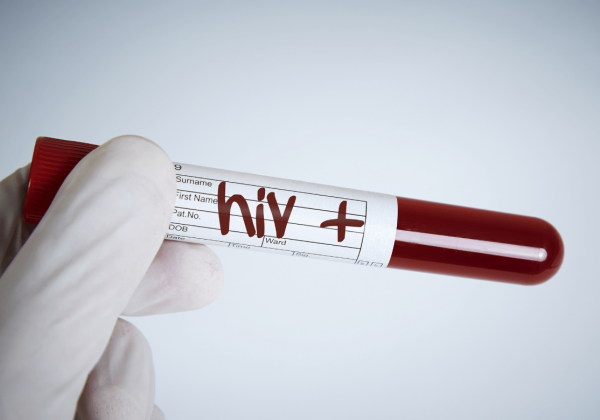 La OMS recomienda el lenacapavir inyectable para prevenir la infección por VIH