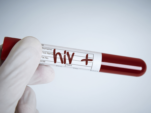 La OMS recomienda el lenacapavir inyectable para prevenir la infección por VIH