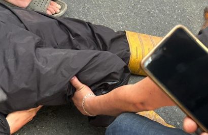 Motociclista pierde una pierna tras accidente con vehículo oficial en Santo Domingo