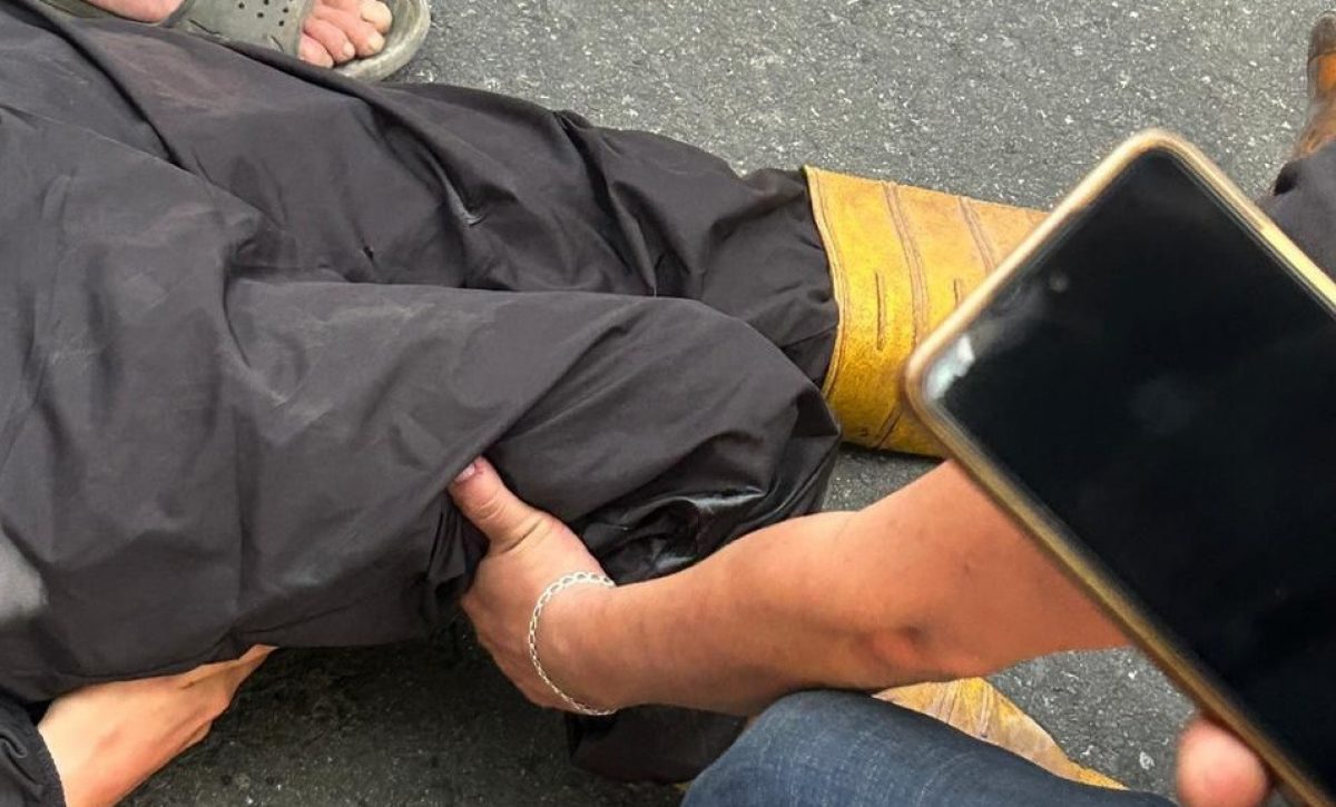 Motociclista pierde una pierna tras accidente con vehículo oficial en Santo Domingo