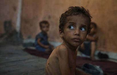 El hambre en Gaza se ensaña con decenas de miles de niños: la malnutrición se triplica en menores de 5 años.
