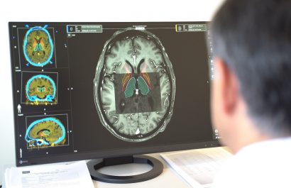 Nuevo hallazgo en fluidos corporales mejora el diagnóstico del Parkinson