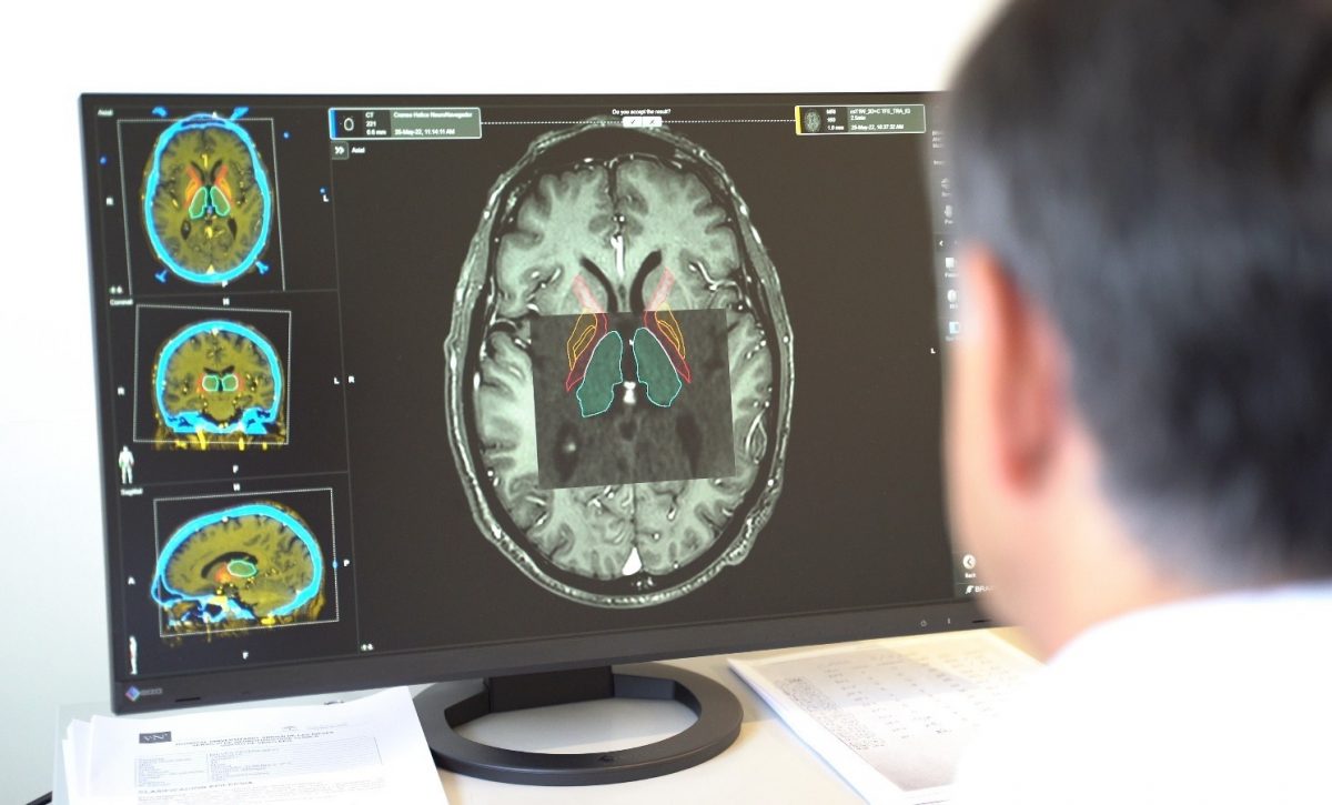 Nuevo hallazgo en fluidos corporales mejora el diagnóstico del Parkinson