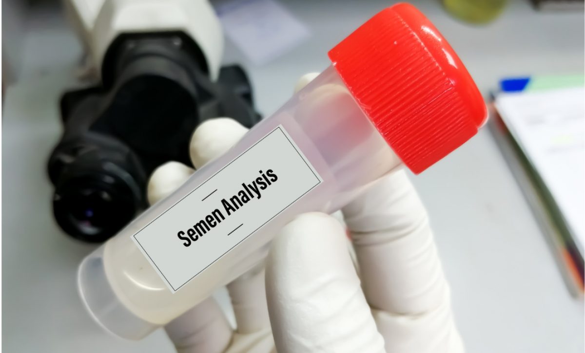 Países Bajos detecta 85 donantes masivos de esperma que superaron límites legales desde 2004