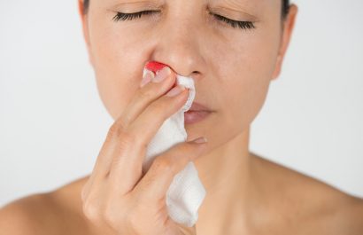 ¿Por qué sangra tu nariz? Descubre causas y trucos preventivos