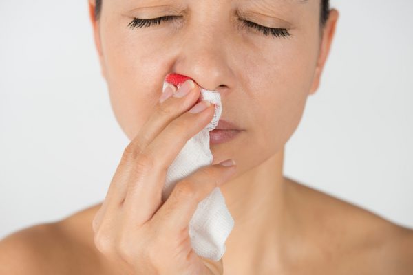 ¿Por qué sangra tu nariz? Descubre causas y trucos preventivos