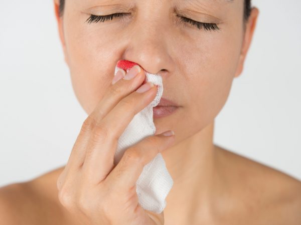 ¿Por qué sangra tu nariz? Descubre causas y trucos preventivos