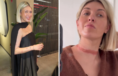 Reconocida influencer casi muere estrangulada por su vestido
