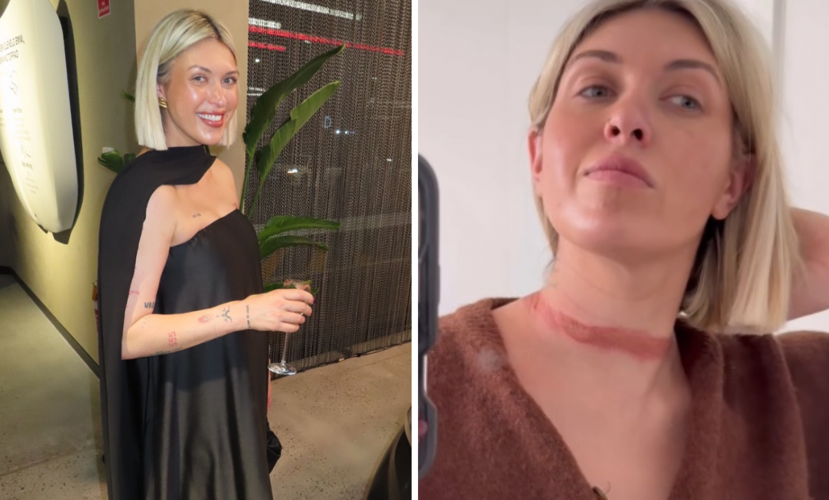 Reconocida influencer casi muere estrangulada por su vestido
