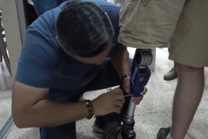 Salud Pública en Ecuador: 8.000 dispositivos de órtesis y prótesis entregados