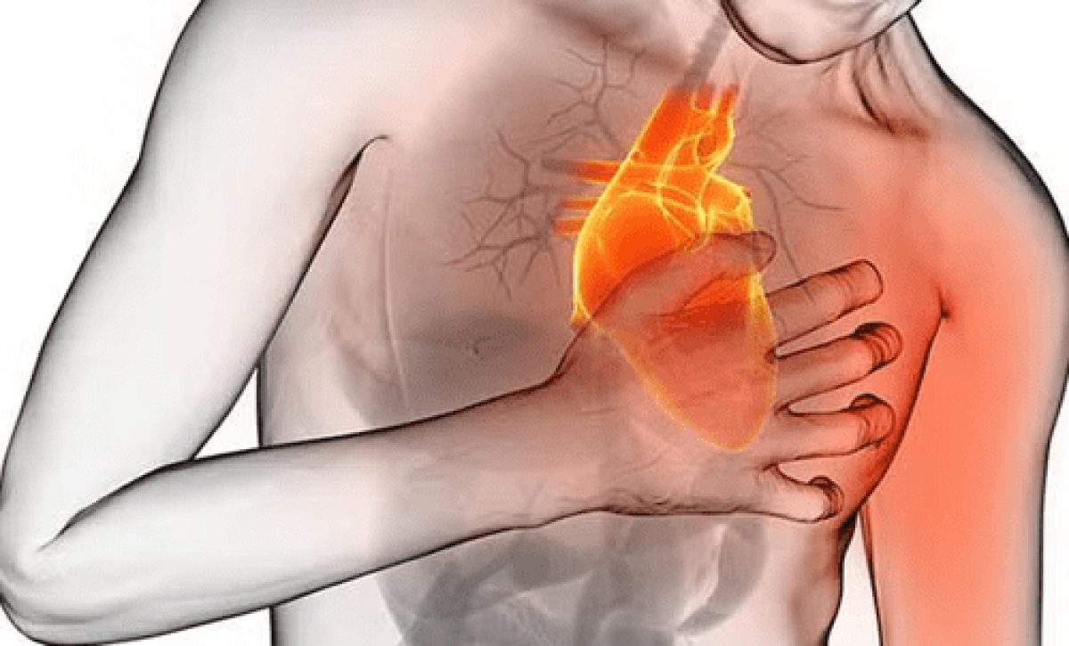 Tu cuerpo podría estar avisando un infarto: aprende a reconocer las señales