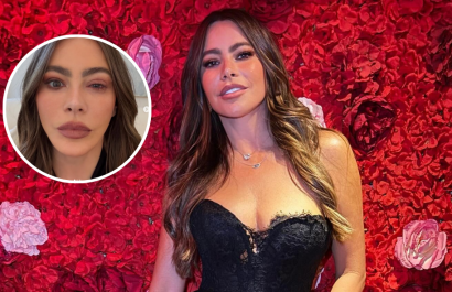 Sofía Vergara compartió una fotografía de su rostro afectado por la alergia.
