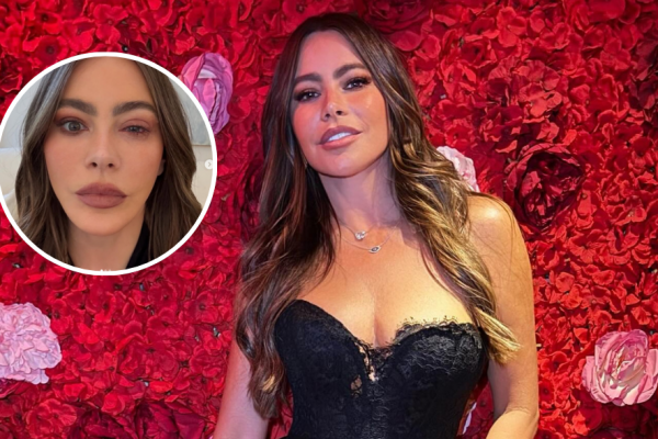Sofía Vergara compartió una fotografía de su rostro afectado por la alergia.