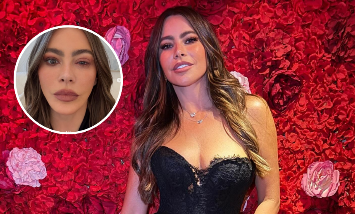 Sofía Vergara compartió una fotografía de su rostro afectado por la alergia.