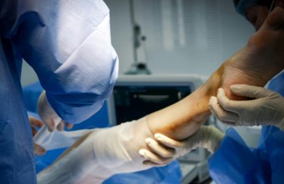 Una mujer fue a ligarse las trompas y terminó con una pierna amputada y con trasplante de corazón, ¿qué le pasó? (Pexels)