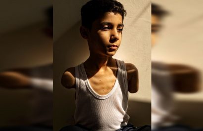 Fotografía de niño mutilado en Gaza gana el World Press Photo 2025
